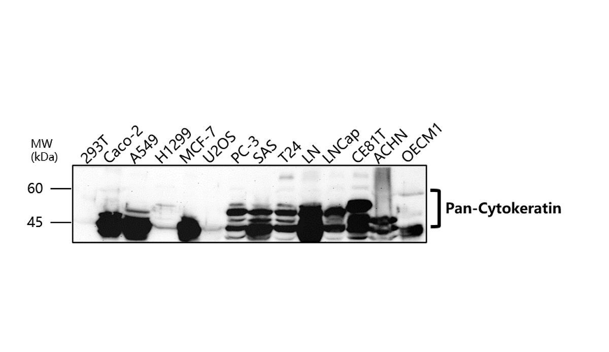 Pan-Cytokeratin, Pan-CK Antibody