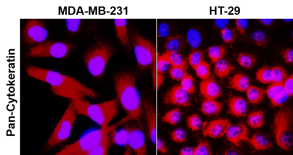 Pan-Cytokeratin, Pan-CK Antibody