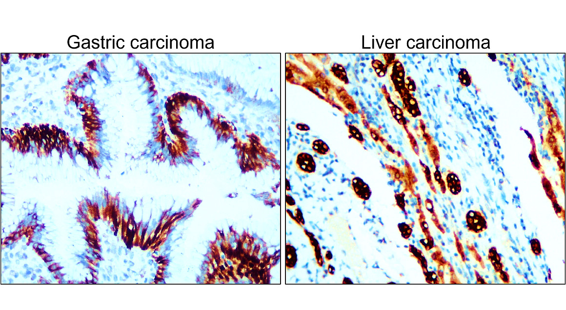 Pan-Cytokeratin, Pan-CK