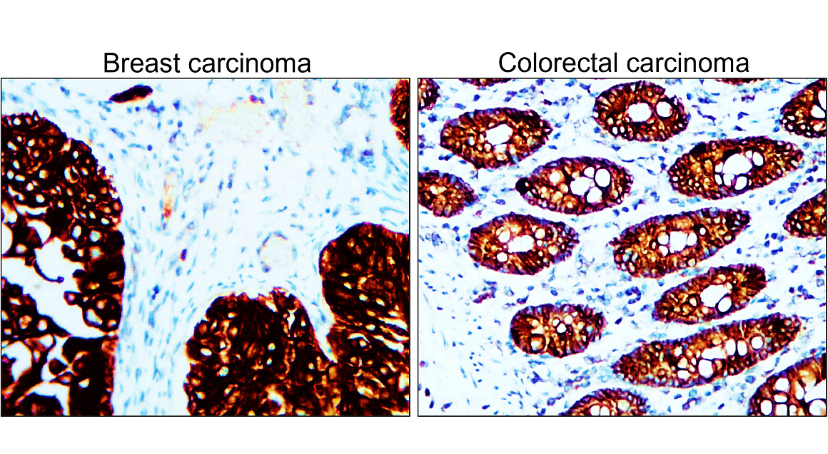 Pan-Cytokeratin, Pan-CK