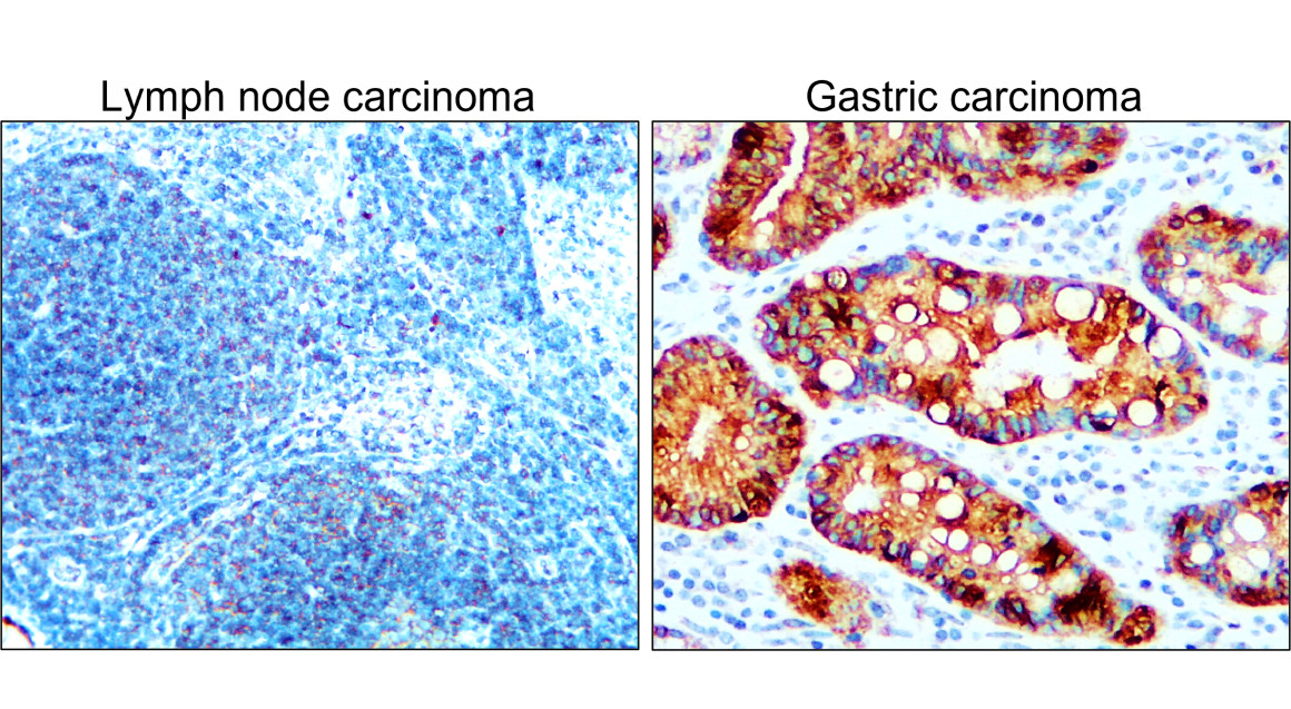 Pan-Cytokeratin, Pan-CK