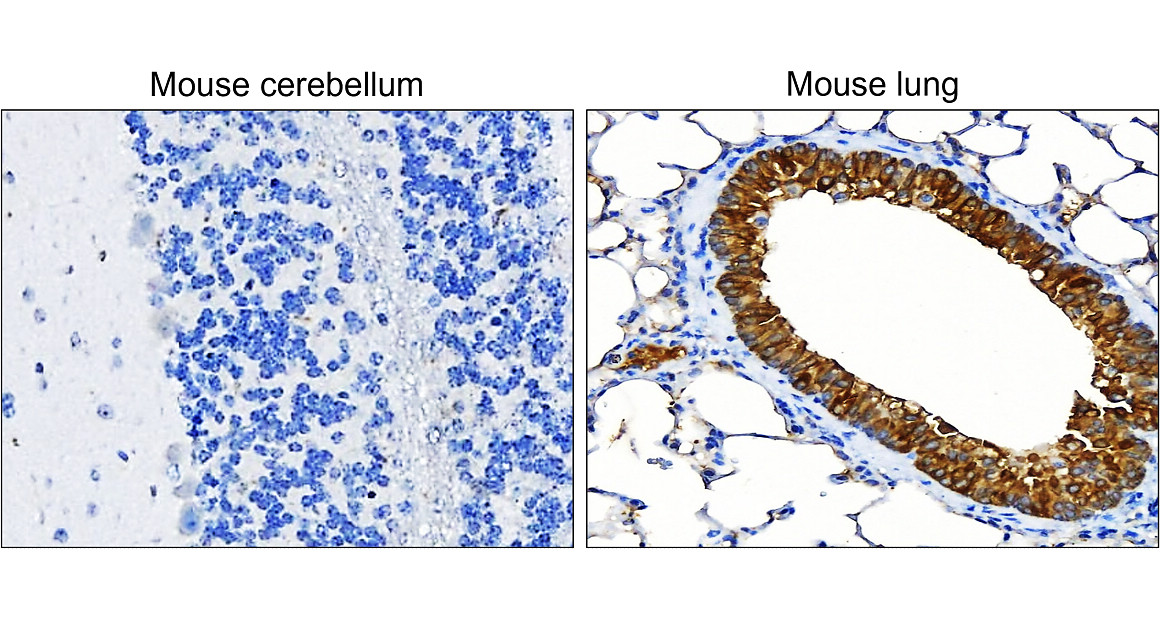 Pan-Cytokeratin, Pan-CK Antibody