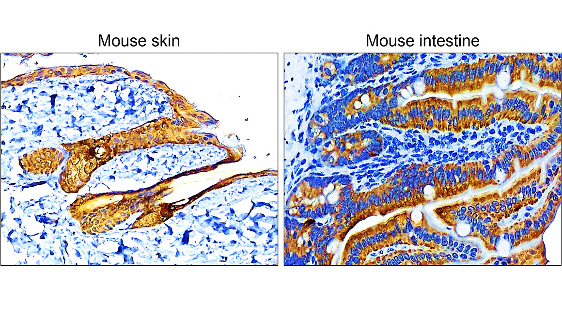 Pan-Cytokeratin, Pan-CK