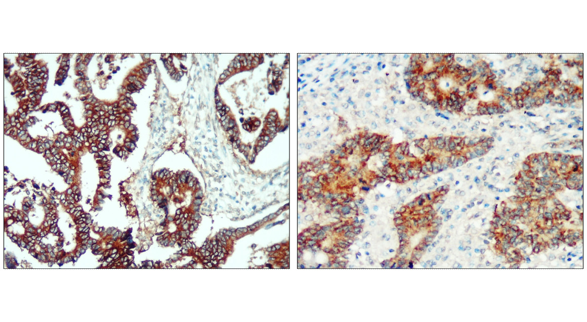 EpCAM (Extracellular domain) antibody