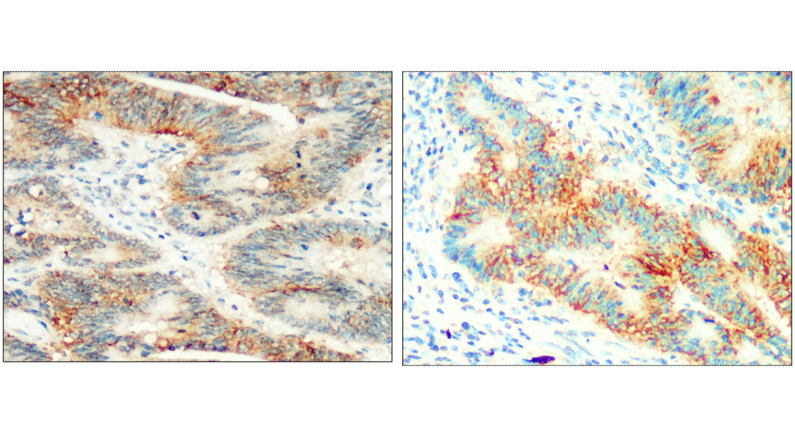 EpCAM (Extracellular domain) antibody