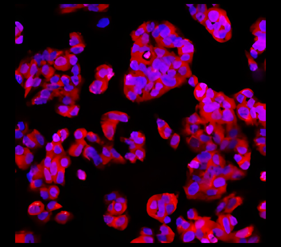 EpCAM (Extracellular domain) antibody