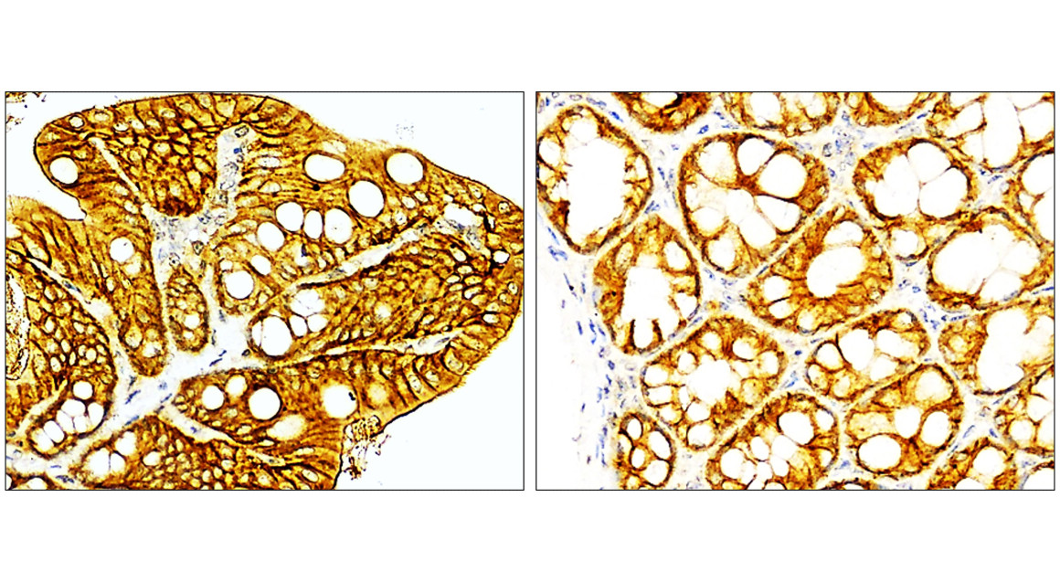 EpCAM (Extracellular domain) antibody