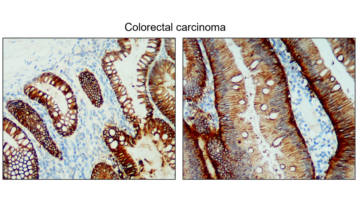 EpCAM (intracellular domain) antibody