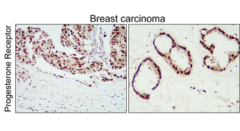 PGR Rabbit Polyclonal Antibody