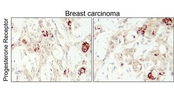PGR Rabbit Polyclonal Antibody
