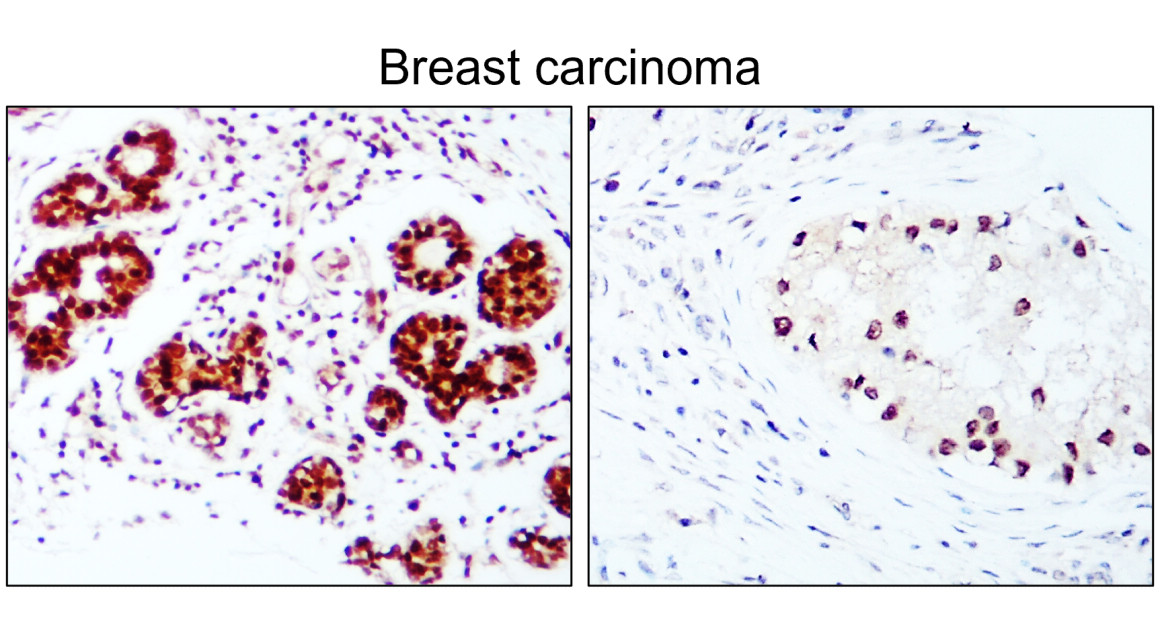 ESR1/Estrogen receptor alpha Antibody