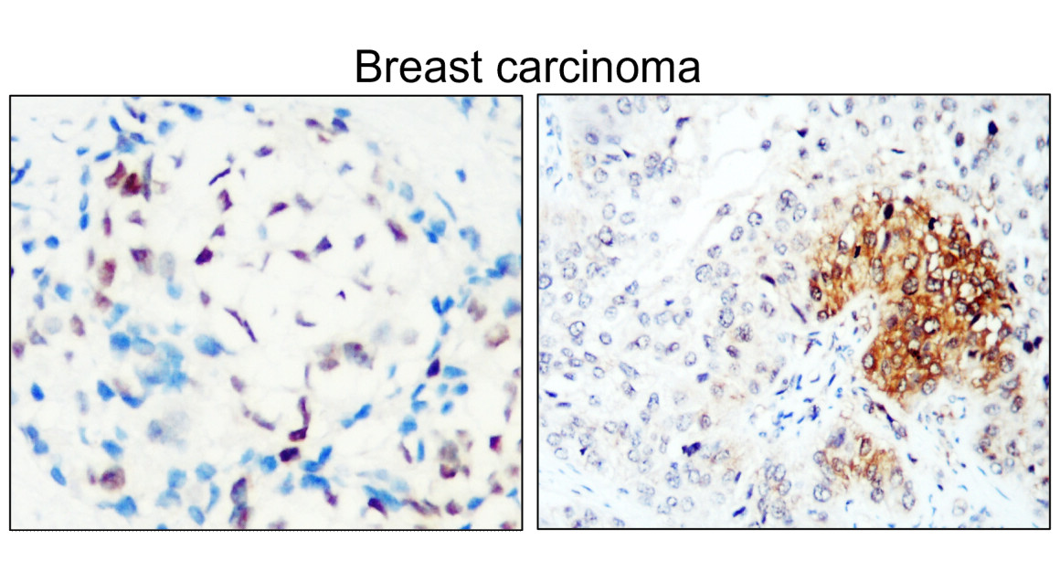 ESR1/Estrogen receptor alpha Antibody