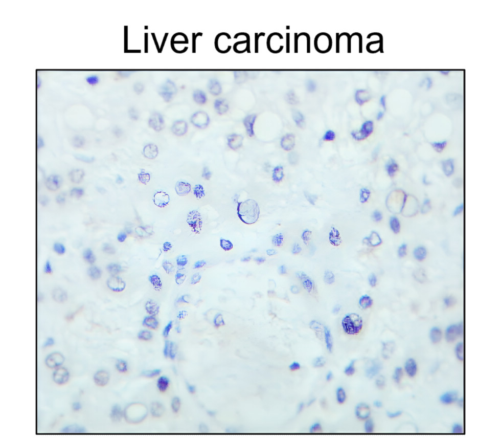 ESR1/Estrogen receptor alpha Antibody