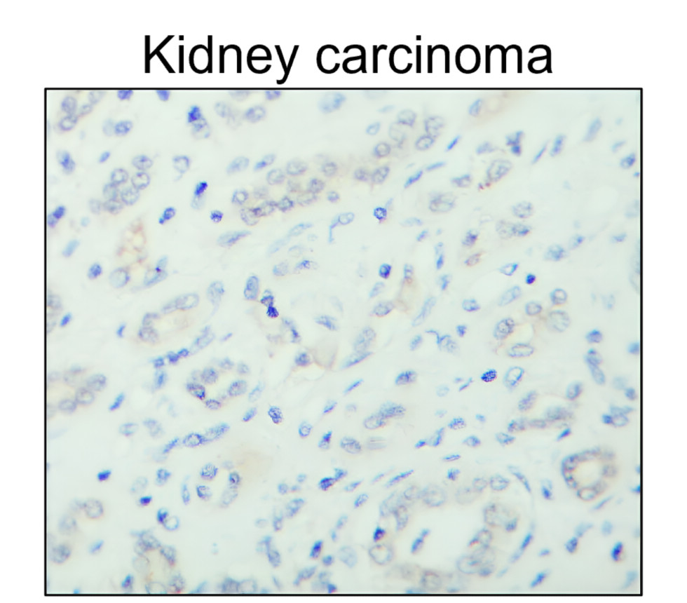 ESR1/Estrogen receptor alpha Antibody