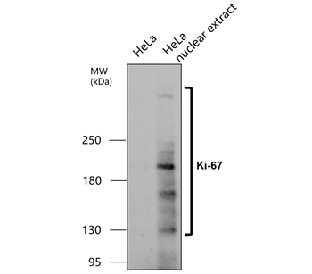 KI-67/MKI67 Antibody