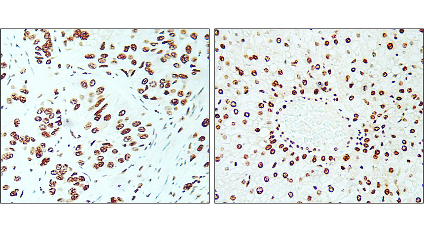 KI-67/MKI67 Antibody