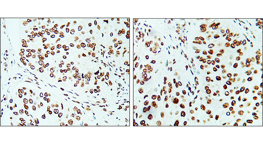 KI-67/MKI67 Antibody