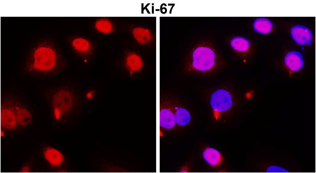 KI-67/MKI67 Antibody
