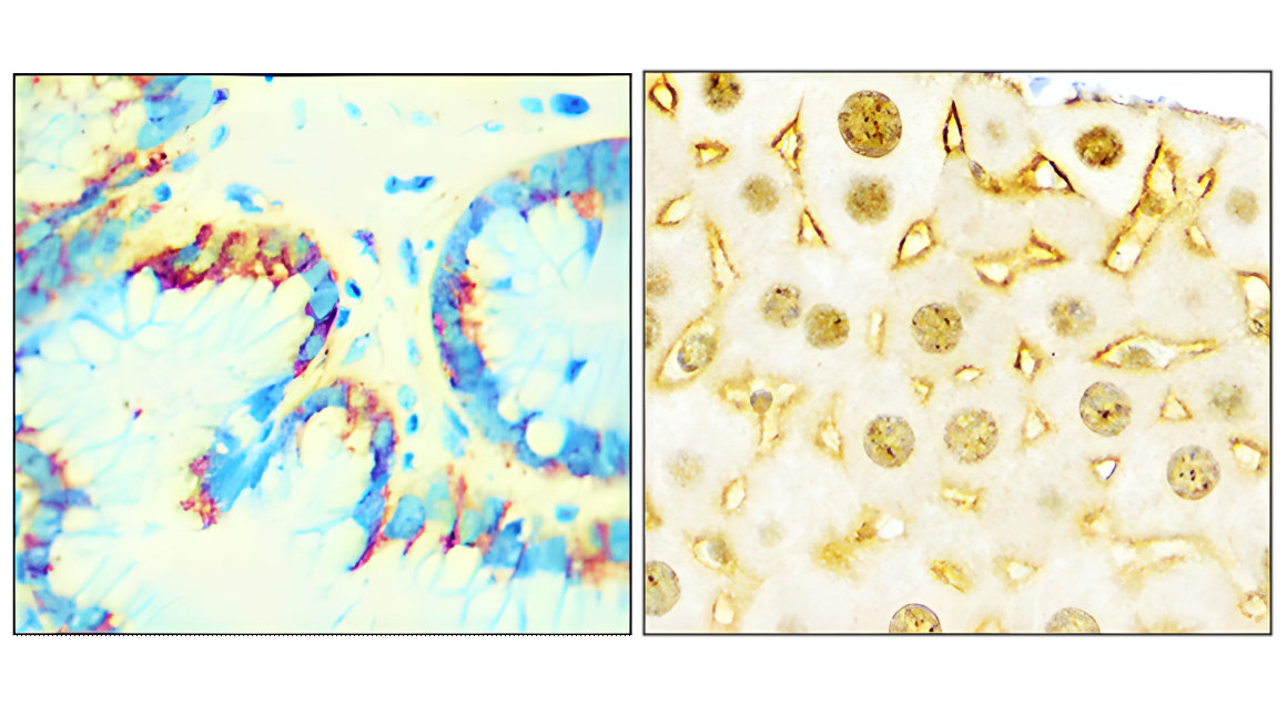 EGFR Antibody