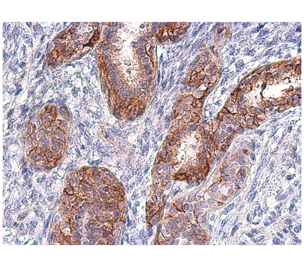 EGFR Antibody
