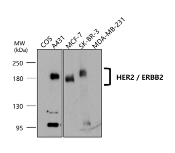 HER2/ERBB2 Antibody