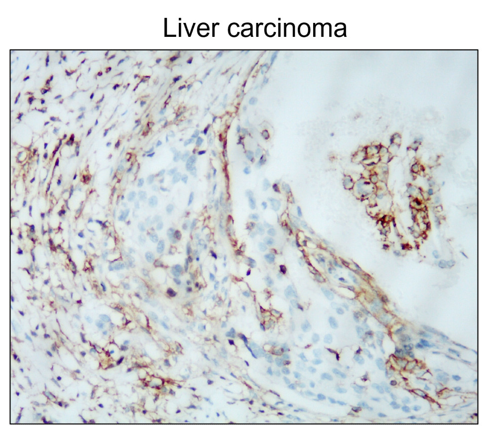 CD44 Antibody