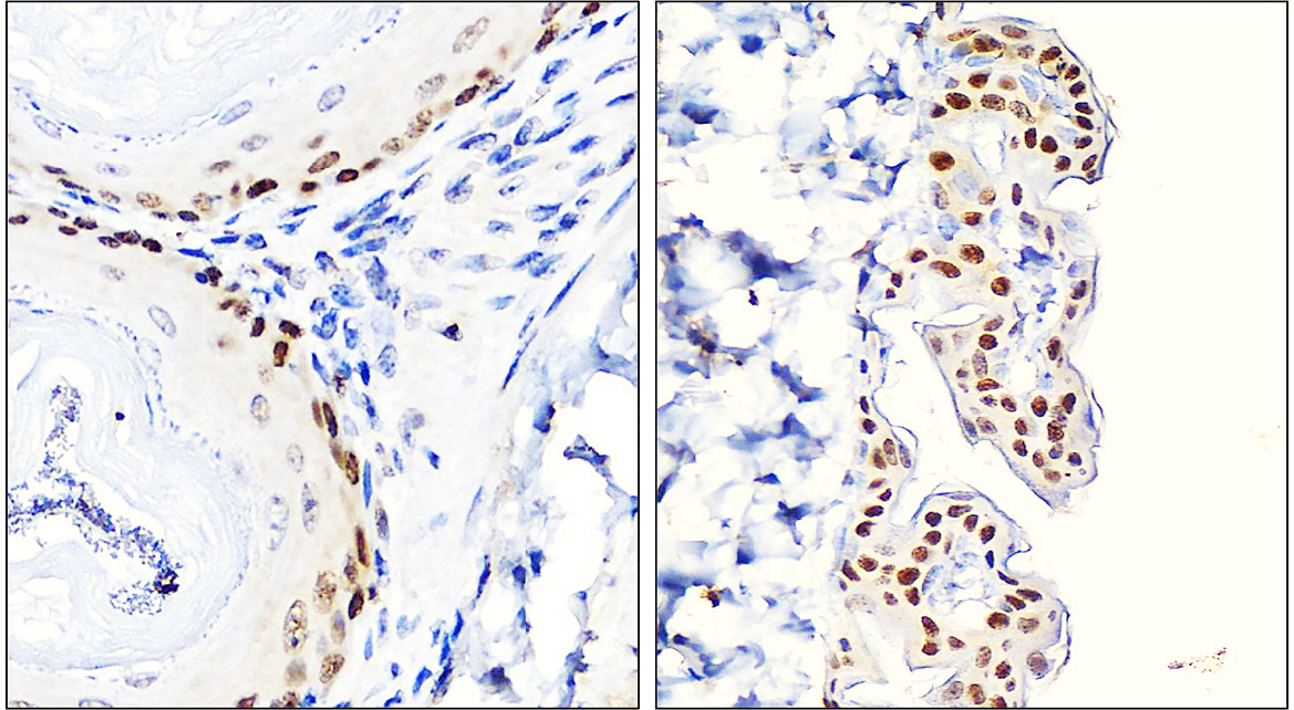 p63 Antibody