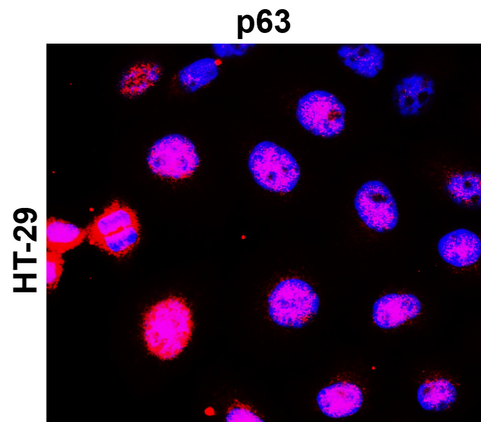 p63 Antibody