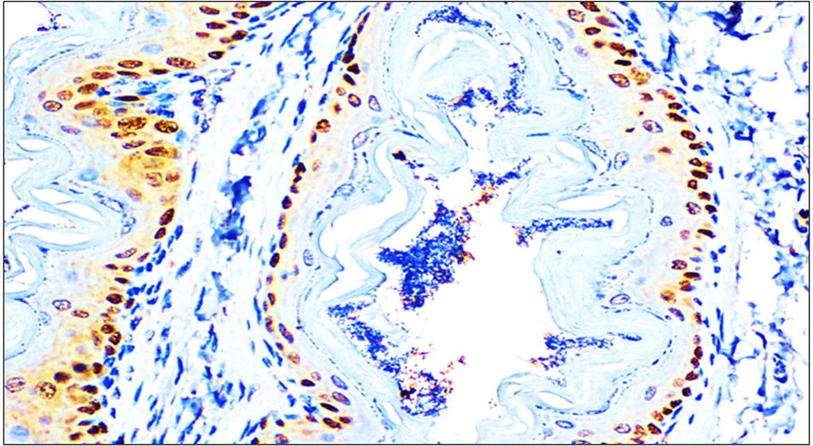 p63 Antibody