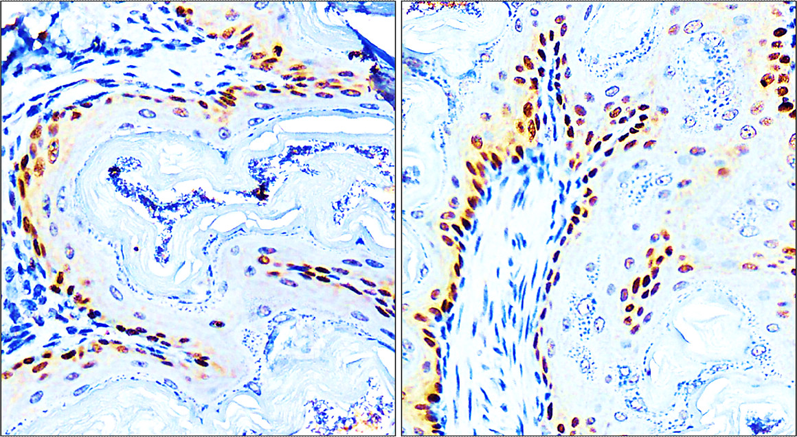 p63 Antibody