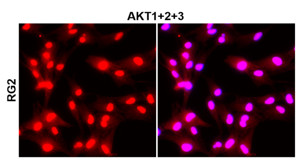 Akt1+2+3 / Pan-AKT