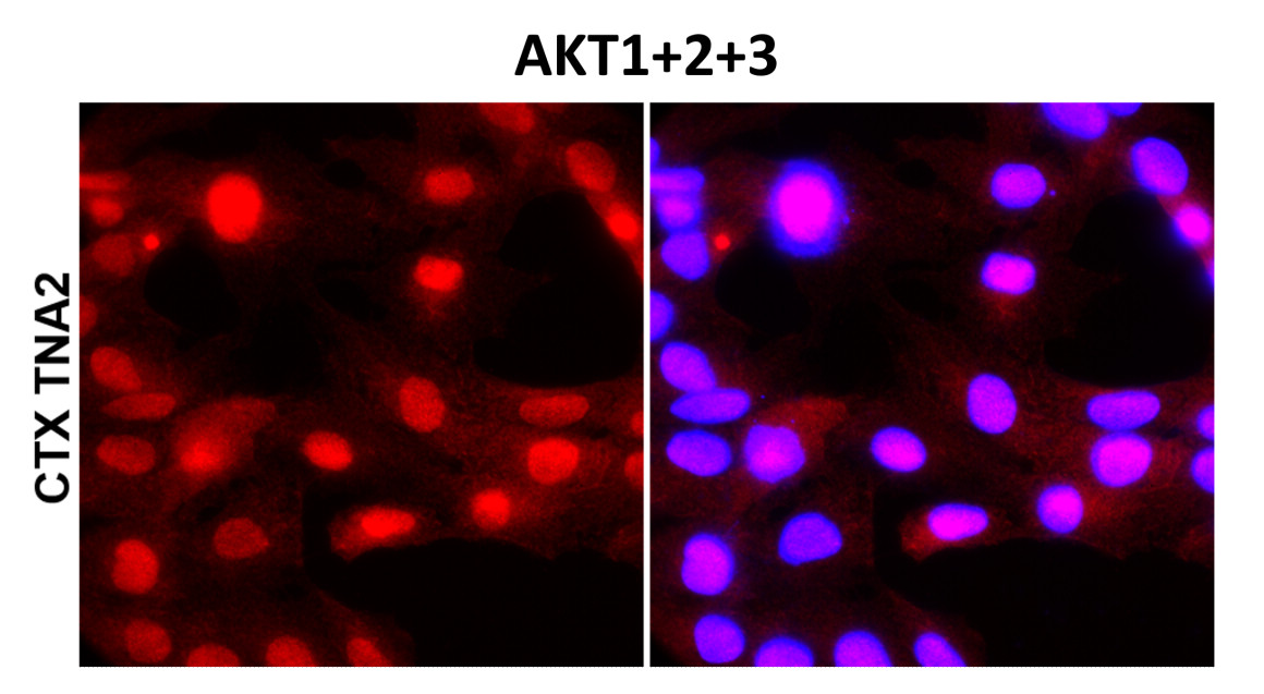 Akt1+2+3 / Pan-AKT