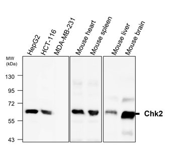 Chk2 Rabbit Polyclonal Antibody
