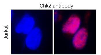 Chk2 Rabbit Polyclonal Antibody