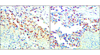 Chk2 Rabbit Polyclonal Antibody
