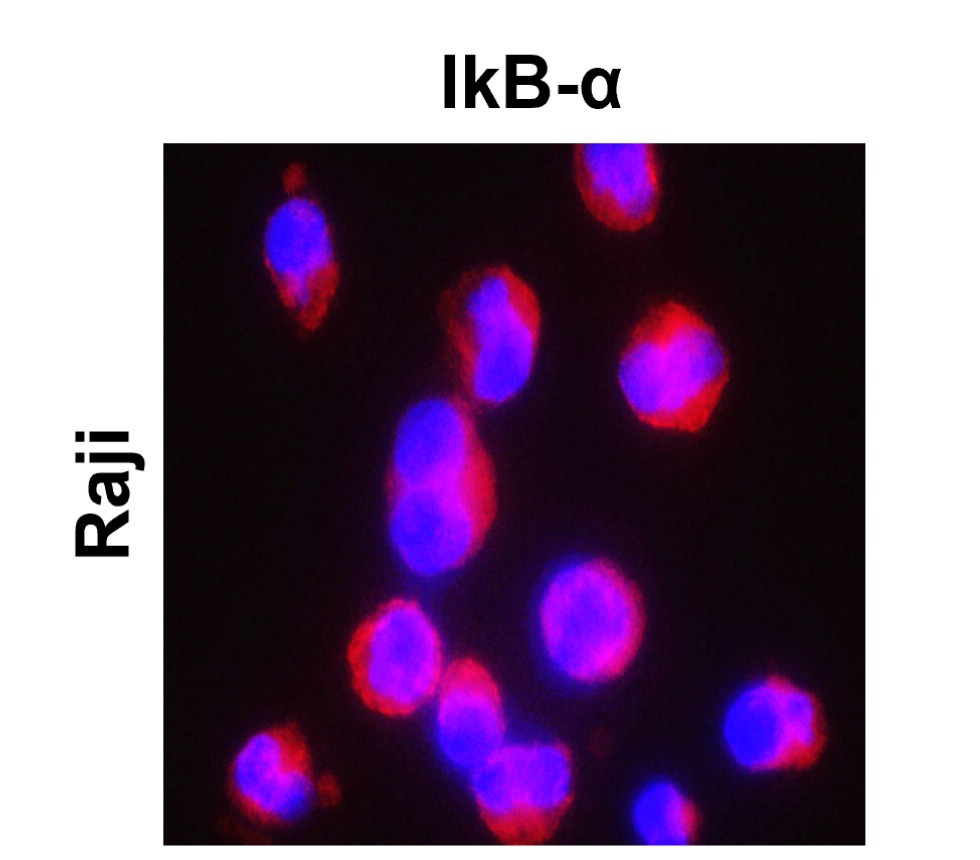 IKB alpha/NFKBIA Antibody