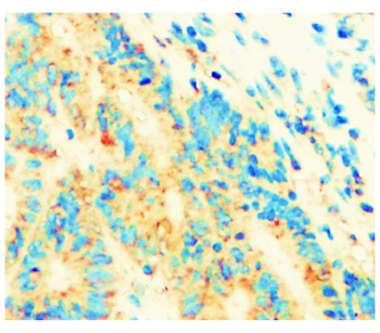 IKB alpha/NFKBIA Antibody