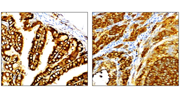 NF-κB p65 Rabbit Polyclonal Antibody