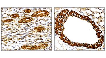 NF-κB p65 Rabbit Polyclonal Antibody