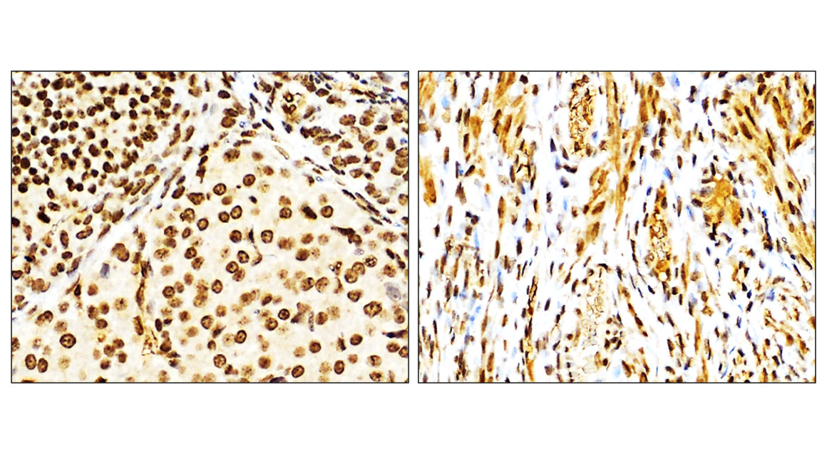 NFE2L2 / NRF2