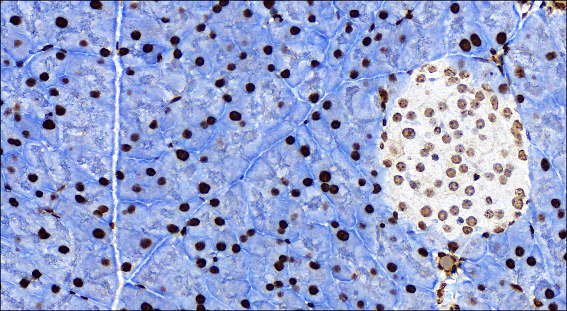 NFE2L2 / NRF2