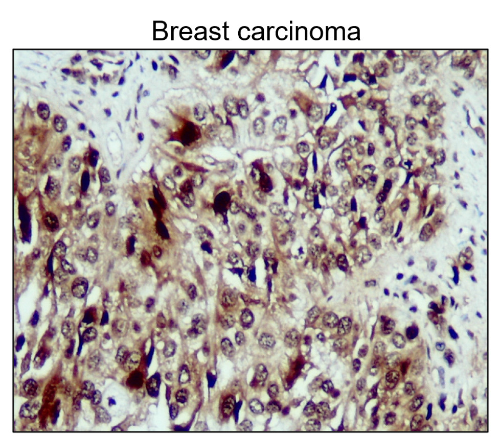 NFE2L2 / NRF2