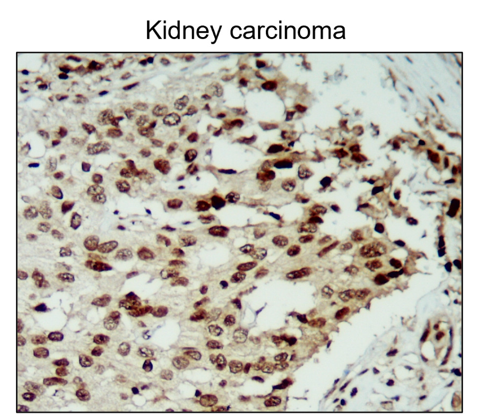 NFE2L2 / NRF2