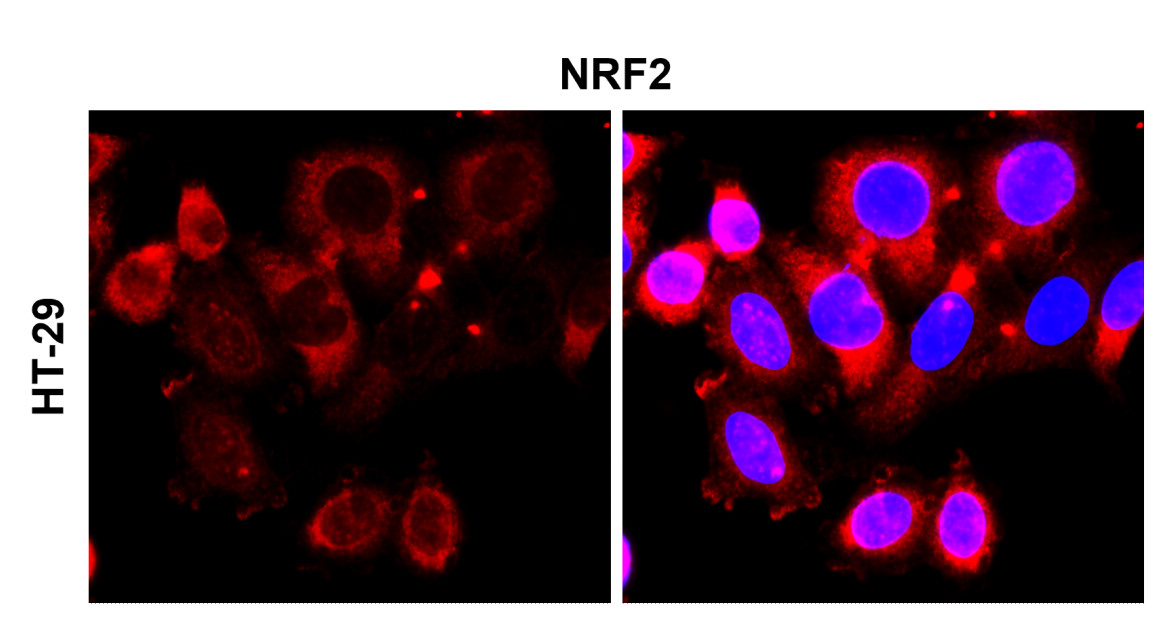 NFE2L2 / NRF2