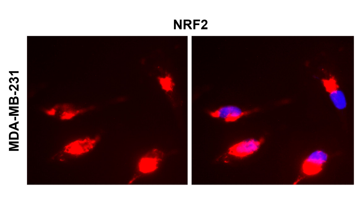 NFE2L2 / NRF2