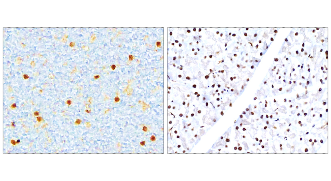NFE2L2 / NRF2