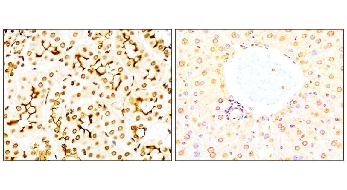 NFE2L2 / NRF2