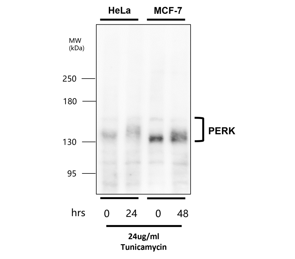 PERK/EIF2AK3 Antibody