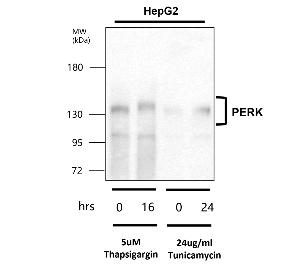 PERK/EIF2AK3 Antibody