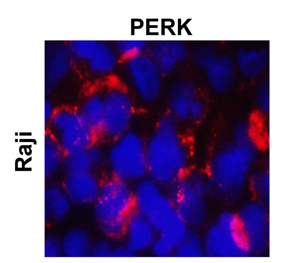PERK/EIF2AK3 Antibody